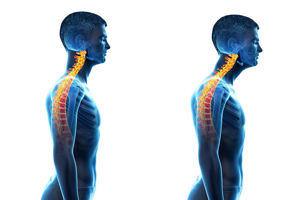 fix-nerd-neck